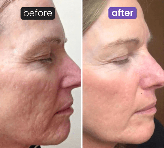 Lunelàh Beauty Sculptor - lunelàh