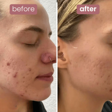 Lunelàh Bio - Collagen Mask - lunelàh