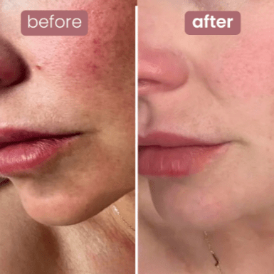 Lunelàh Bio - Collagen Mask - lunelàh