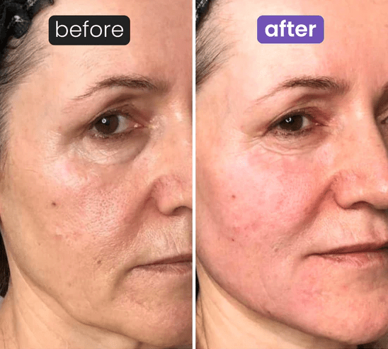 Lunelàh Heart Gua Sha Stone - lunelàh