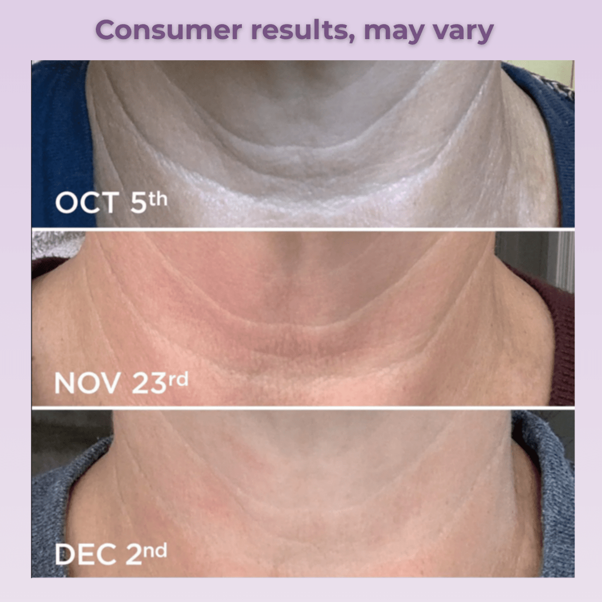 Lunelàh Neck Cream - lunelàh