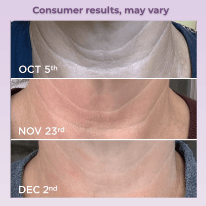 Lunelàh Neck Cream - lunelàh