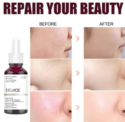 Skin Refining Serum - lunelàh